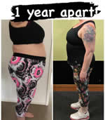 Before Virtual Gastric Band